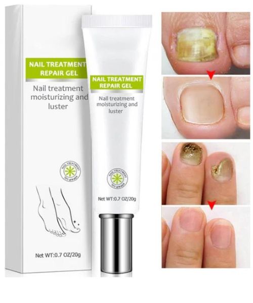 Nail Addict Nail 7 Days Treatment Gel